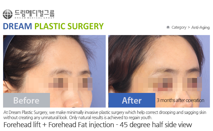 관련이미지