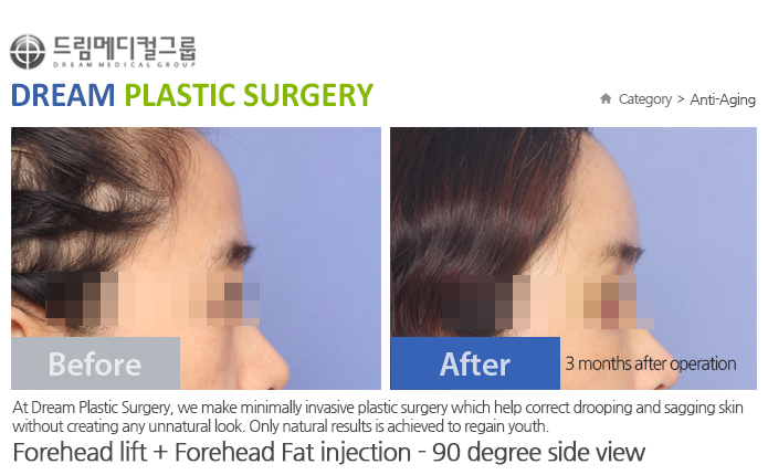관련이미지