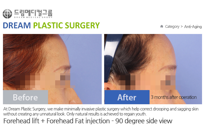 관련이미지
