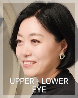 상.하안검